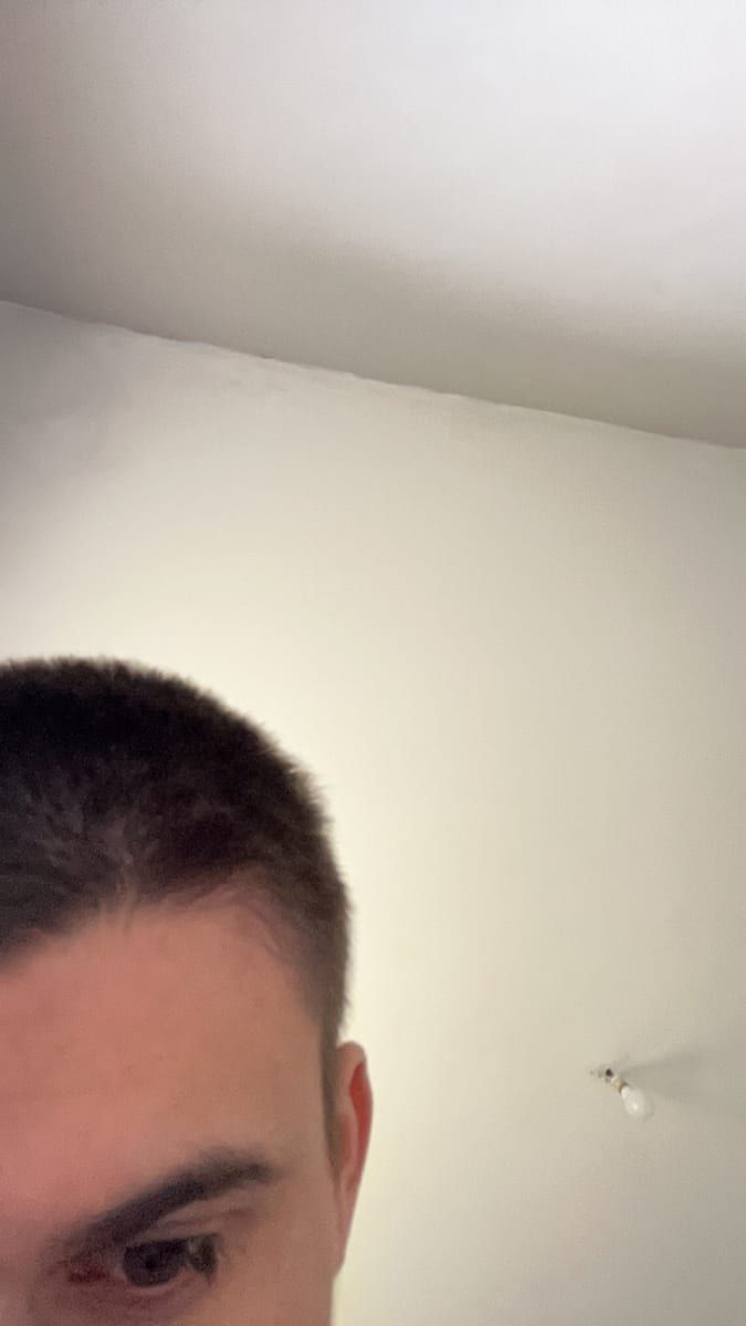 Profil von Ervin